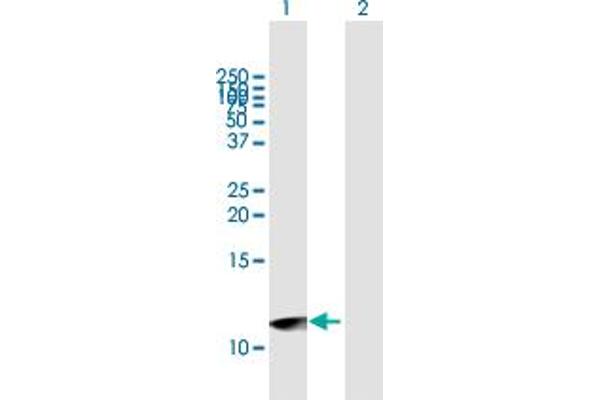 Urotensin 2B antibody  (AA 1-119)