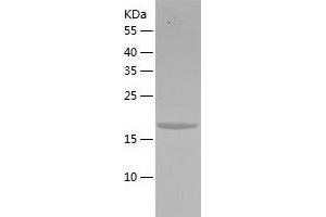 Western Blotting (WB) image for NTF2-Related Export Protein 1 (NXT1) (AA 1-160) protein (His tag) (ABIN7289343) (NXT1 Protein (AA 1-160) (His tag))