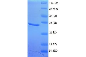 SDS-PAGE (SDS) image for Chromodomain Helicase DNA Binding Protein 4 (CHD4) (AA 1-219), (partial) protein (His tag) (ABIN4976290)