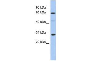 WB Suggested Anti-PIAS3 Antibody Titration:  0. (PIAS3 antibody  (Middle Region))