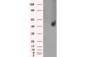 Image no. 2 for anti-Solute Carrier Family 2 (Facilitated Glucose/fructose Transporter), Member 5 (SLC2A5) antibody (ABIN1498472) (SLC2A5 antibody)