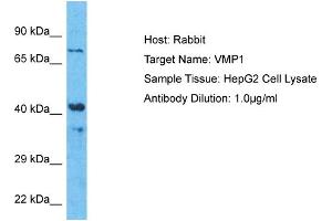 Host:  Rabbit  Target Name:  VMP1  Sample Type:  HepG2 Whole Cell lysates  Antibody Dilution:  1. (VMP1 antibody  (Middle Region))