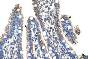 Image no. 1 for anti-Solute Carrier Family 25, Member 39 (SLC25A39) (C-Term) antibody (ABIN6736659)