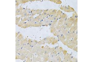 Immunohistochemistry of paraffin-embedded rat heart using PPA1 Antibody. (Pyrophosphatase (Inorganic) 1 (PPA1) (AA 1-289) antibody)