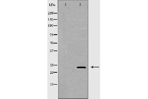 Western blot analysis of 293T  lysate using EDN1 antibody. (Endothelin 1 antibody  (C-Term))