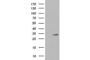 HEK293T cells were transfected with the pCMV6-ENTRY control (Left lane) or pCMV6-ENTRY TPSG1 (Right lane) cDNA for 48 hrs and lysed. (TPSG1 antibody  (AA 20-283))