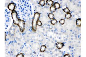 CASR was detected in paraffin-embedded sections of mouse kidney tissues using rabbit anti- CASR Antigen Affinity purified polyclonal antibody (Catalog # ) at 1 ? (CASR antibody  (AA 926-1078))
