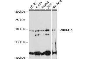 Western blot analysis of extracts of various cell lines, using  antibody (ABIN6129195, ABIN6137096, ABIN6137097 and ABIN6220538) at 1:3000 dilution. (ARHGEF5 antibody  (AA 1248-1597))