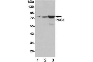Western blot testing of 1) human C2C12, 2) monkey COS7 and 3) rat C6 cell lysates using PKC alpha antibody at 1:1000.