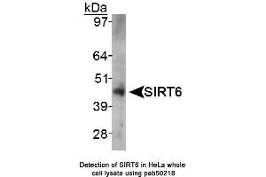Image no. 1 for anti-Sirtuin 6 (SIRT6) (AA 250-350), (Internal Region) antibody (ABIN363527) (SIRT6 antibody  (Internal Region))