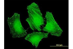 Immunofluorescence of monoclonal antibody to FERMT2 on HeLa cell. (FERMT2 antibody  (AA 1-680))