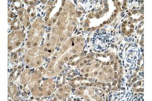 TBX15 antibody was used for immunohistochemistry at a concentration of 4-8 ug/ml to stain Epithelial cells of renal tubule (arrows) in Human Kidney.