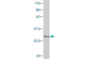 CDK12 antibody  (AA 1281-1380)