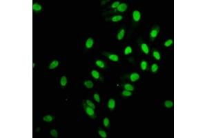 Immunofluorescence staining of Hela cells with ABIN7127293 at 1:168,counter-stained with DAPI. (Recombinant HIST1H2AB antibody)