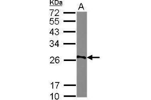 WB Image Sample (30 ug of whole cell lysate) A: Raji 12% SDS PAGE antibody diluted at 1:500