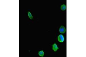 Immunofluorescent analysis of MCF-7 cells using ABIN7158712 at dilution of 1:100 and Alexa Fluor 488-congugated AffiniPure Goat Anti-Rabbit IgG(H+L) (KDM5C antibody  (AA 45-324))