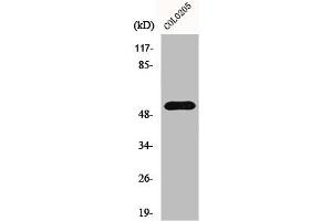 Western Blot analysis of COLO205 cells using HisRS Polyclonal Antibody (HARS1/Jo-1 antibody  (C-Term))