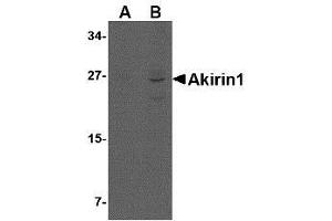 Western blot analysis of Akirin1 in rat liver lysate with AP30039PU-N Akirin1 antibody at (A) 1 and (B) 2 μg/ml. (Akirin 1 antibody  (Center))