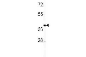 Western blot analysis of IGHM antibody and T47D lysate. (IGHM antibody  (AA 103-131))