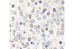 Immunohistochemistry (IHC) image for anti-Histone Deacetylase 7 (HDAC7) (AA 902-952) antibody (ABIN7448594) (HDAC7 antibody  (AA 902-952))
