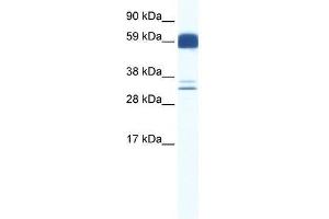 ZIC5 antibody used at 0.