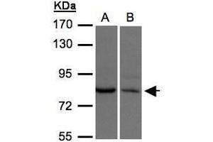 WB Image Sample(30 μg of whole cell lysate) A:H1299 B:Hep G2, 7. (xpr1 antibody  (N-Term))