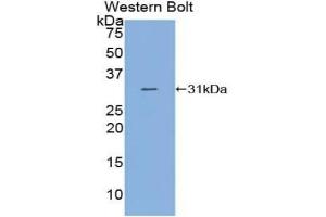 Detection of Recombinant C2, Human using Polyclonal Antibody to Complement Component 2 (C2) (Complement C2 antibody  (AA 245-451))