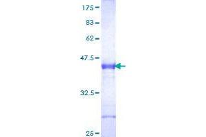 Image no. 1 for Dickkopf Homolog 1 (DKK1) (AA 81-180) protein (GST tag) (ABIN1351649) (DKK1 Protein (AA 81-180) (GST tag))