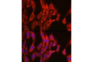 Immunofluorescence (IF) image for anti-GTPase NRas (NRAS) (AA 1-189) antibody (ABIN7267532)