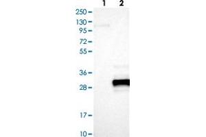 Western blot analysis of Lane 1: Negative control (vector only transfected HEK293T lysate), Lane 2: Over-expression lysate (Co-expressed with a C-terminal myc-DDK tag (~3. (UBE2E3 antibody)