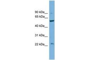 Image no. 1 for anti-Protein Phosphatase 5, Catalytic Subunit (PPP5C) (C-Term) antibody (ABIN6746460)