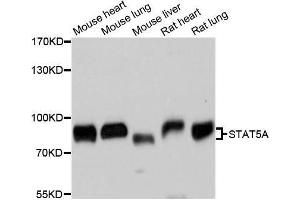 Western blot analysis of extracts of various cell lines, using STAT5A antibody. (STAT5A antibody)