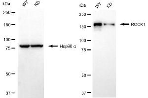 Western blotting analysis using ROCK1 antibody (ABIN7800201). (Recombinant ROCK1 antibody)