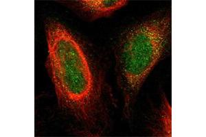 Immunofluorescent staining of human cell line U-2 OS shows positivity in nucleus & cytoplasm.