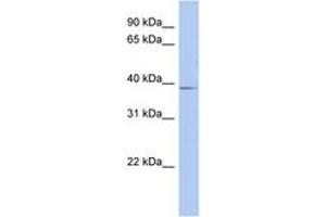 Image no. 1 for anti-Solute Carrier Family 25, Member 28 (SLC25A28) (AA 215-264) antibody (ABIN6743232) (SLC25A28 antibody  (AA 215-264))