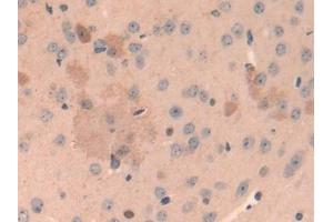 #VALUE! (Cathepsin L antibody  (AA 18-113))