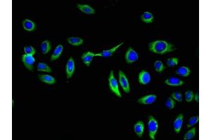 Immunofluorescent analysis of A549 cells using ABIN7154060 at dilution of 1:100 and Alexa Fluor 488-congugated AffiniPure Goat Anti-Rabbit IgG(H+L) (GGT1 antibody  (AA 13-225))