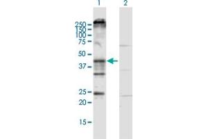 Western Blot analysis of KCNN4 expression in transfected 293T cell line by KCNN4 MaxPab polyclonal antibody. (KCNN4 antibody  (AA 1-427))