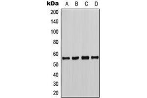 Western blot analysis of CHK1 (pS286) expression in HeLa (A), K562 (B), NIH3T3 (C), H9C2 (D) whole cell lysates. (CHEK1 antibody  (pSer286))