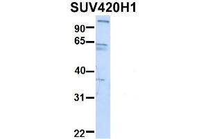 Host:  Rabbit  Target Name:  GNAS  Sample Type:  Human Fetal Heart  Antibody Dilution:  1. (SUV420H1 antibody  (Middle Region))