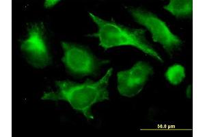 Immunofluorescence of monoclonal antibody to B2M on HeLa cell. (beta-2 Microglobulin antibody  (AA 1-119))