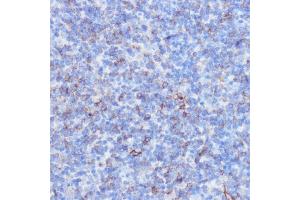 Immunohistochemistry of paraffin-embedded mouse spleen using NOTCH3 antibody (ABIN6134401, ABIN6144738, ABIN6144739 and ABIN6217553) at dilution of 1:100 (40x lens).