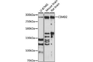 Western blot analysis of extracts of various cell lines, using CSMD2 antibody (ABIN7266537) at 1:1000 dilution. (CSMD2 antibody  (AA 2050-2150))