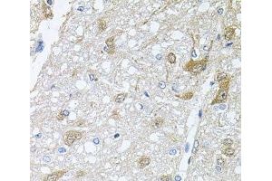 Immunohistochemistry of paraffin-embedded Rat brain using RAPSN Polyclonal Antibody at dilution of 1:100 (40x lens). (RAPSN antibody)