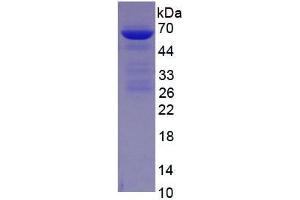 Image no. 2 for Albumin (ALB) (AA 25-609) protein (His tag) (ABIN2120495)