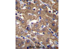 UGDH Antibody (C-term) immunohistochemistry analysis in formalin fixed and paraffin embedded human liver tissue followed by peroxidase conjugation of the secondary antibody and DAB staining. (UGDH antibody  (C-Term))