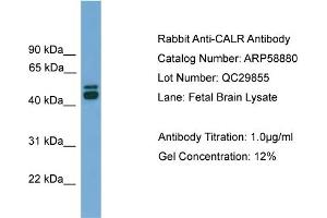 WB Suggested Anti-CALR  Antibody Titration: 0. (Calreticulin antibody  (Middle Region))