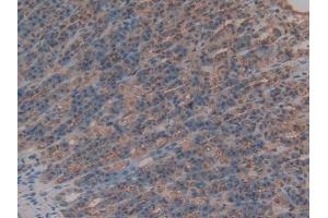 Immunohistochemistry (IHC) image for anti-Anti-Mullerian Hormone (AMH) (AA 447-553) antibody (ABIN7431407)