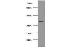 Western blot All lanes: Creatine kinase M-type antibody at 2 μg/mL + 293T whole cell lysate Secondary Goat polyclonal to rabbit IgG at 1/10000 dilution Predicted band size: 44 kDa Observed band size: 44 kDa (CKM antibody  (AA 1-379))