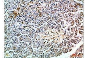 Immunohistochemical analysis of paraffin-embedded human-pancreas, antibody was diluted at 1:200 (MIA2 antibody  (AA 361-410))